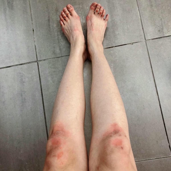 ảnh té xe nữ