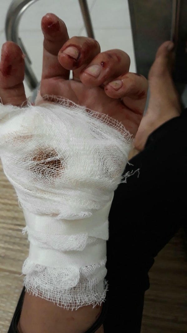 ảnh té xe băng bó