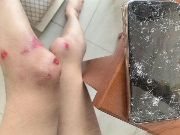 ảnh té xe dau