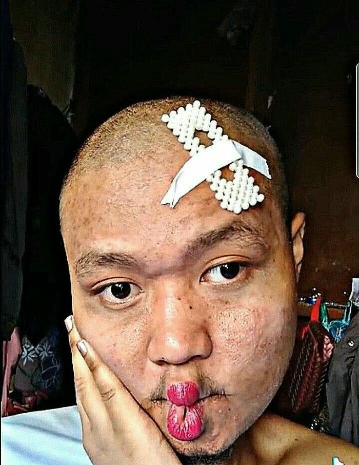 ảnh trai xấu chu mỏ