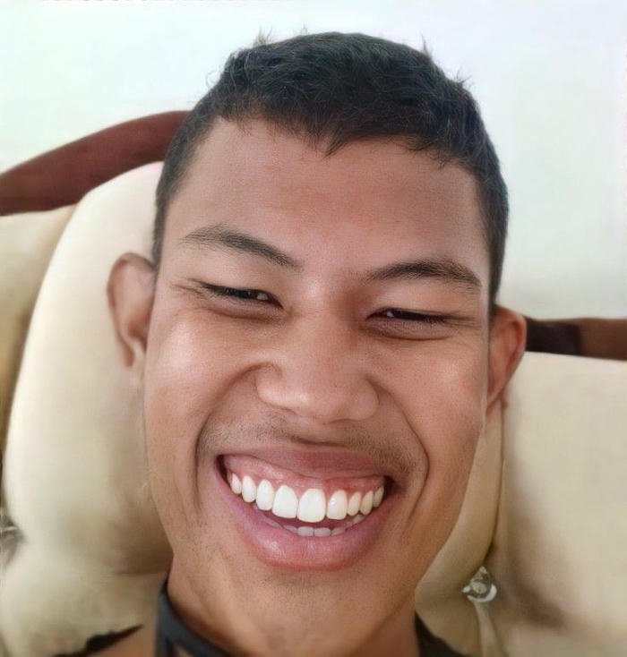 ảnh trai xấu cười