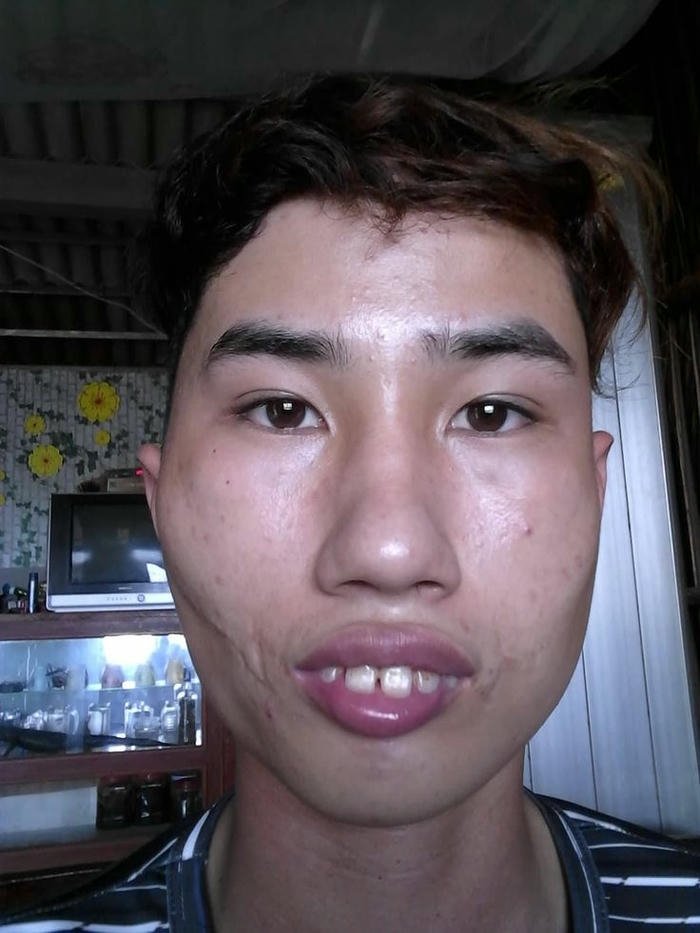ảnh trai xấu hô