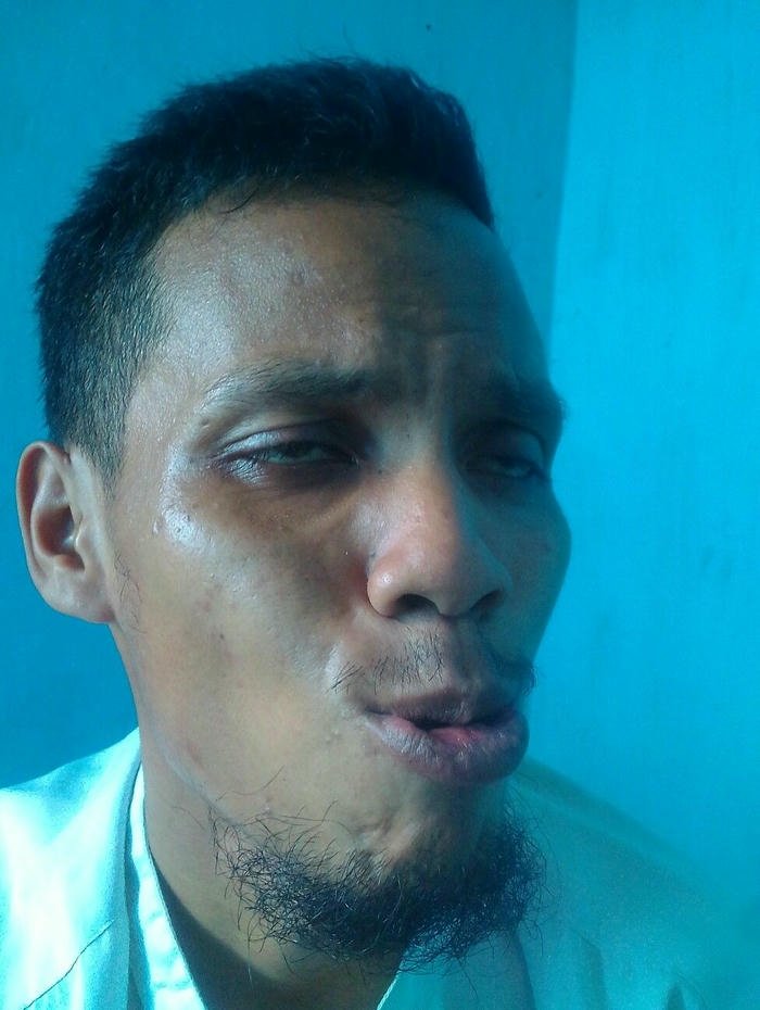 ảnh trai xấu meme