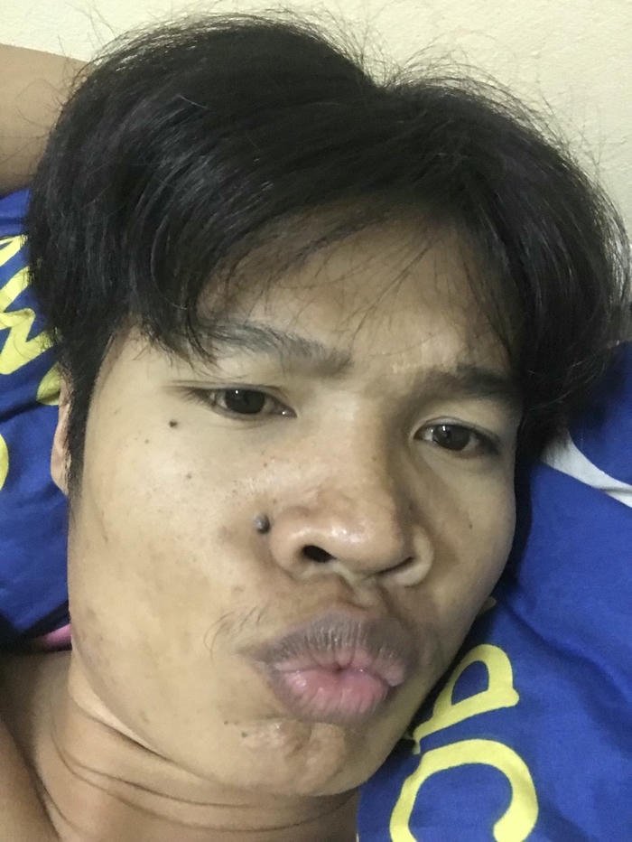 ảnh trai xấu môi thâm