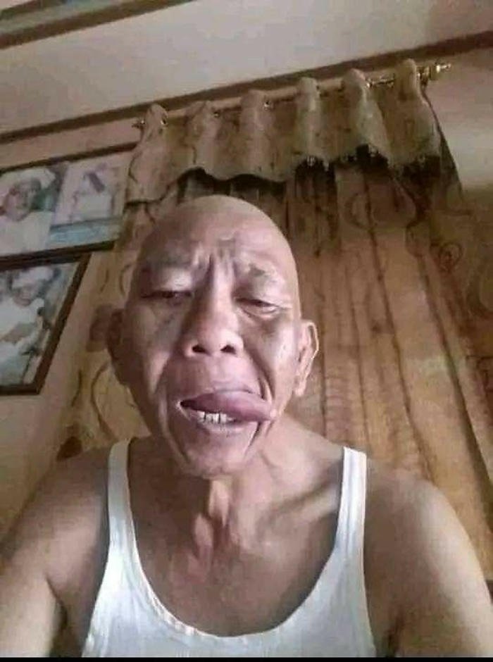 ảnh trai xấu