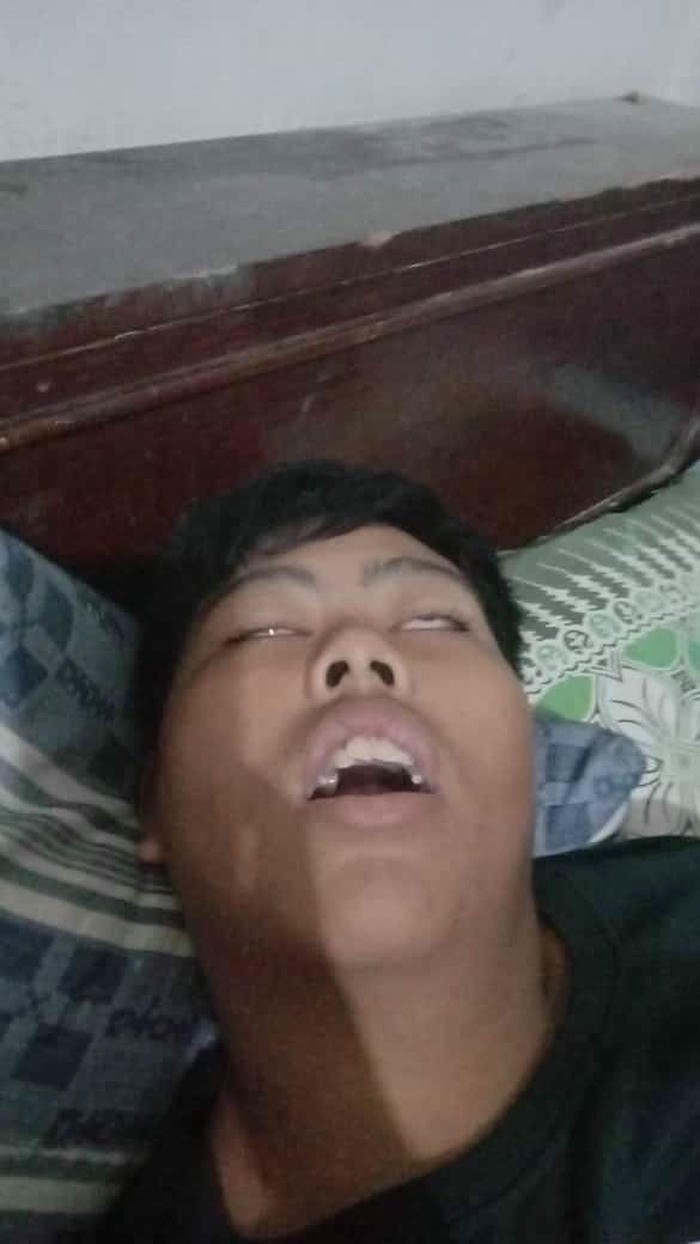 hinh trai xau
